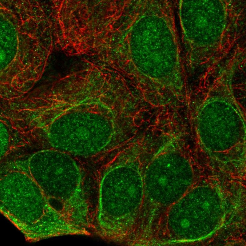 Immunofluorescent staining of human cell line MCF7 shows localization to nucleus, nucleoli, cytosol & intermediate filaments.