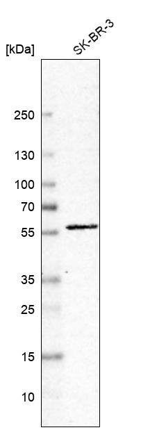 Western blot analysis in human cell line SK-BR-3.