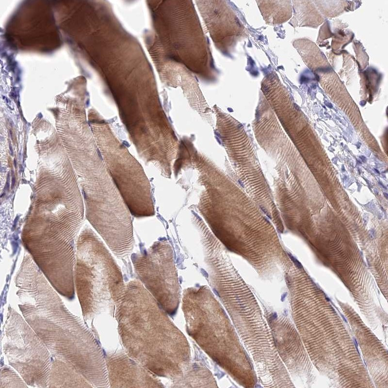 Immunohistochemical staining of human skeletal muscle shows moderate cytoplasmic positivity in myocytes.