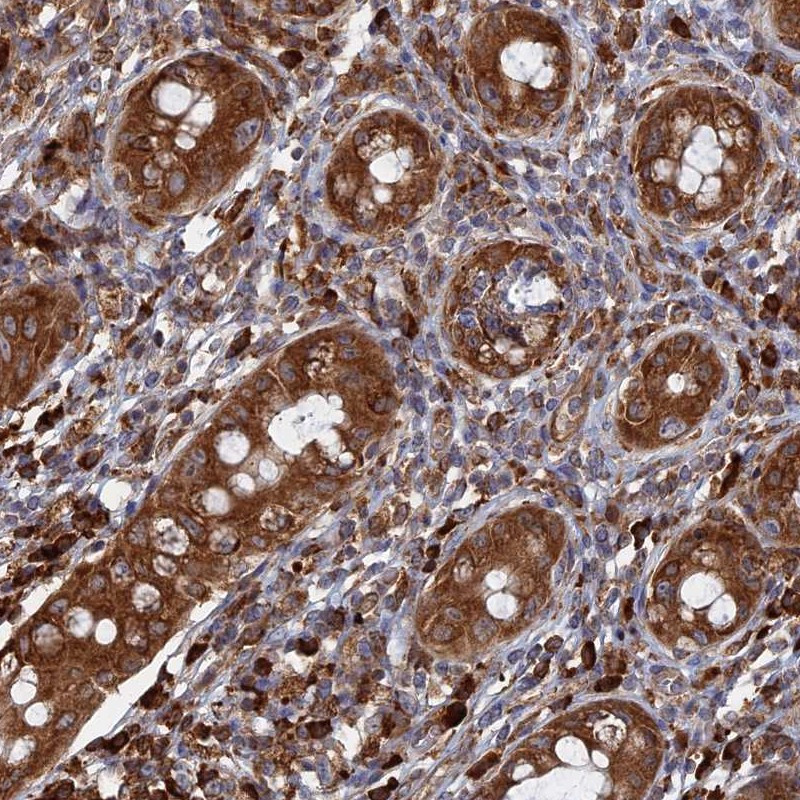 Immunohistochemical staining of human rectum shows strong cytoplasmic positivity in glandular cells.