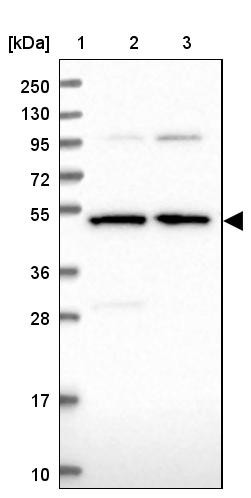 Lane 1: Marker [kDa] 250, 130, 95, 72, 55, 36, 28, 17, 10<br/>Lane 2: Human cell line RT-4<br/>Lane 3: Human cell line U-251MG sp