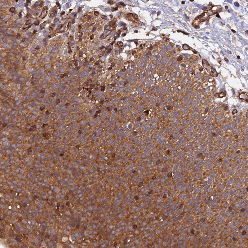 Immunohistochemical staining of human urinary bladder shows moderate cytoplasmic positivity in urothelium.
