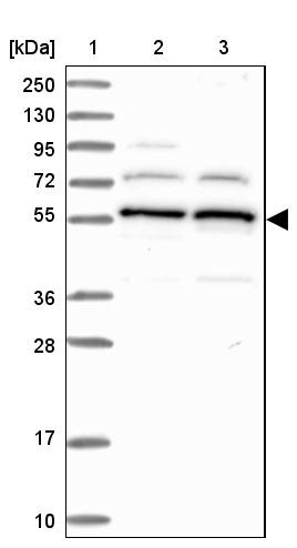 Lane 1: Marker [kDa] 250, 130, 95, 72, 55, 36, 28, 17, 10<br/>Lane 2: Human cell line RT-4<br/>Lane 3: Human cell line U-251MG sp