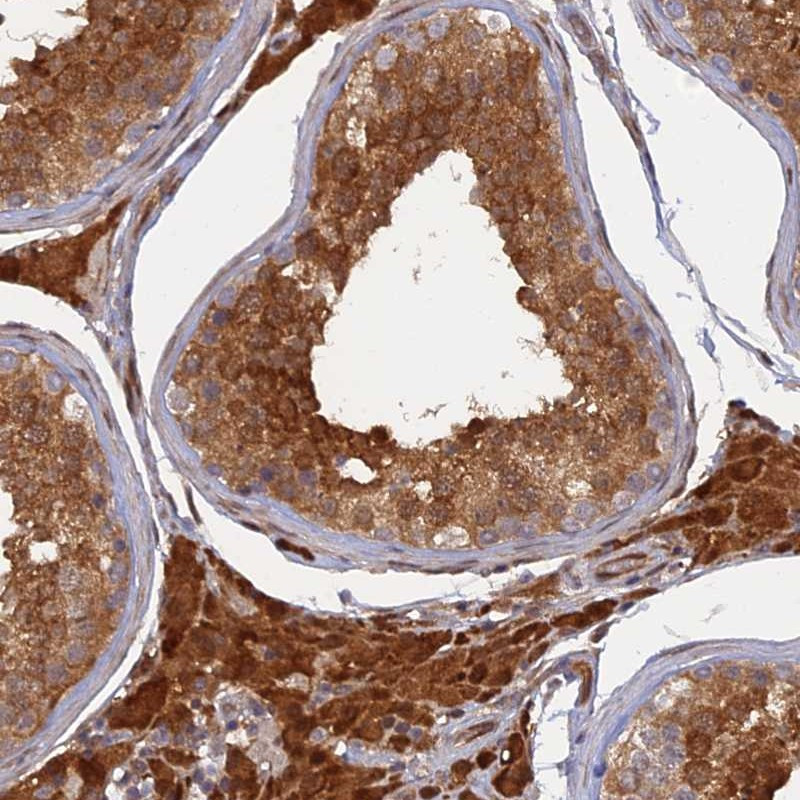 Immunohistochemical staining of human testis shows strong cytoplasmic and nuclear positivity in cells in seminiferus tubules and Leydig cells.