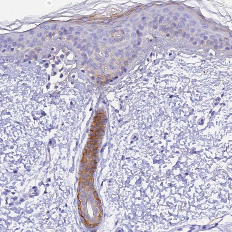 Immunohistochemical staining of human skin shows moderate positivity in hair follicle and a subset of kerationocytes.