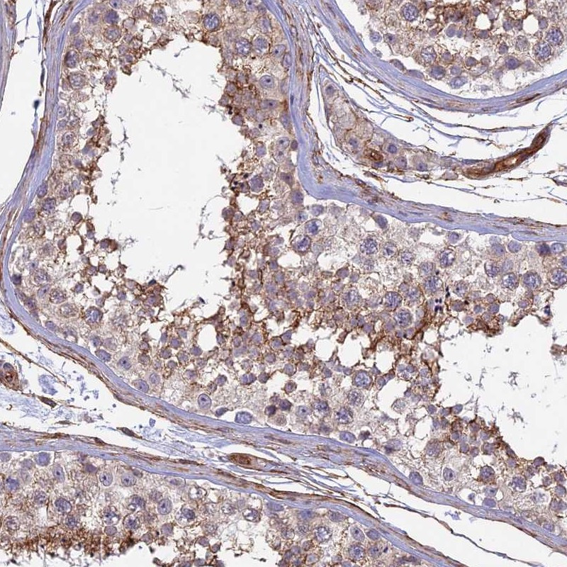 Immunohistochemical staining of human testis shows moderate cytoplasmic positivity in cells in seminiferous ducts and Leydig cells.