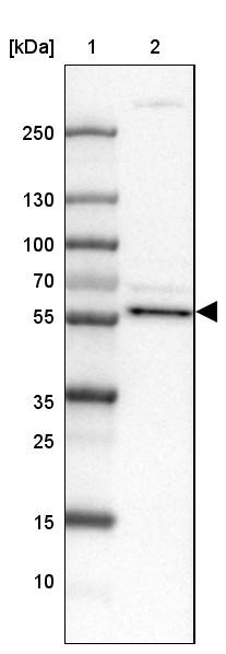 Lane 1: Marker [kDa] 250, 130, 100, 70, 55, 35, 25, 15, 10<br/>Lane 2: Human Tonsil tissue