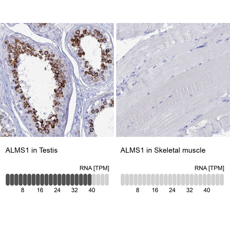 Immunohistochemistry analysis in human testis and skeletal muscle tissues using Anti-ALMS1 antibody. Corresponding ALMS1 RNA-seq data are presented for the same tissues.