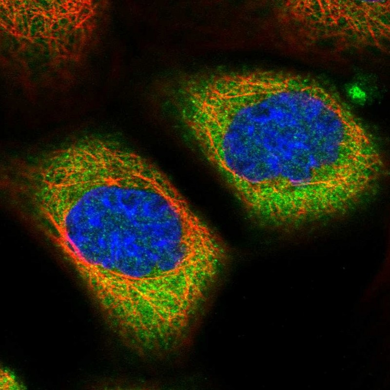 Immunofluorescent staining of human cell line A-431 shows localization to cytosol.