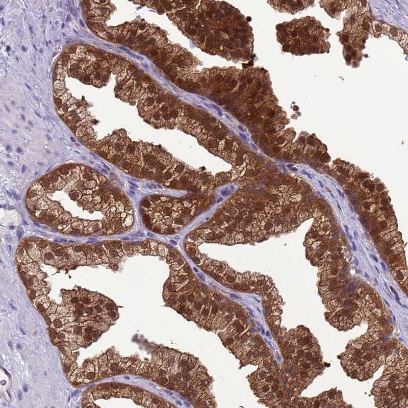 Immunohistochemical staining of human prostate shows strong cytoplasmic and nuclear positivity in glandular cells.