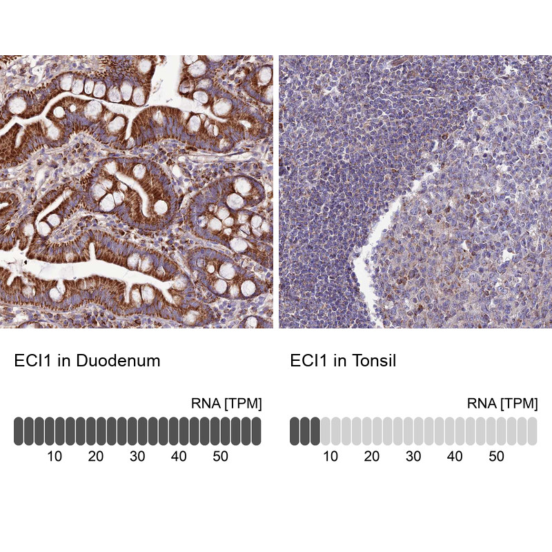 Immunohistochemistry analysis in human duodenum and tonsil tissues using HPA043227 antibody. Corresponding ECI1 RNA-seq data are presented for the same tissues.