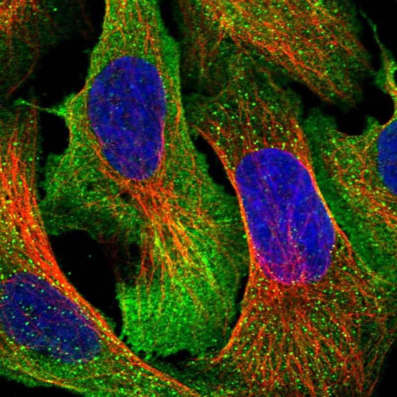 Immunofluorescent staining of human cell line U-2 OS shows localization to plasma membrane & vesicles.
