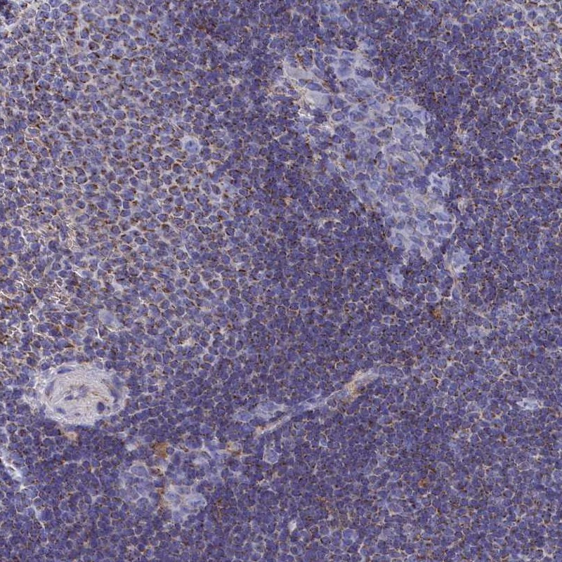 Immunohistochemical staining of human spleen shows moderate cytoplasmic positivity in cells in red pulp and cells in white pulp.