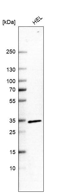 Western blot analysis in human cell line HEL.