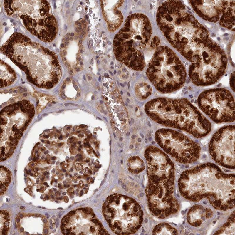 Immunohistochemical staining of human kidney shows strong cytoplasmic positivity in cells in tubules and cells in glomeruli.