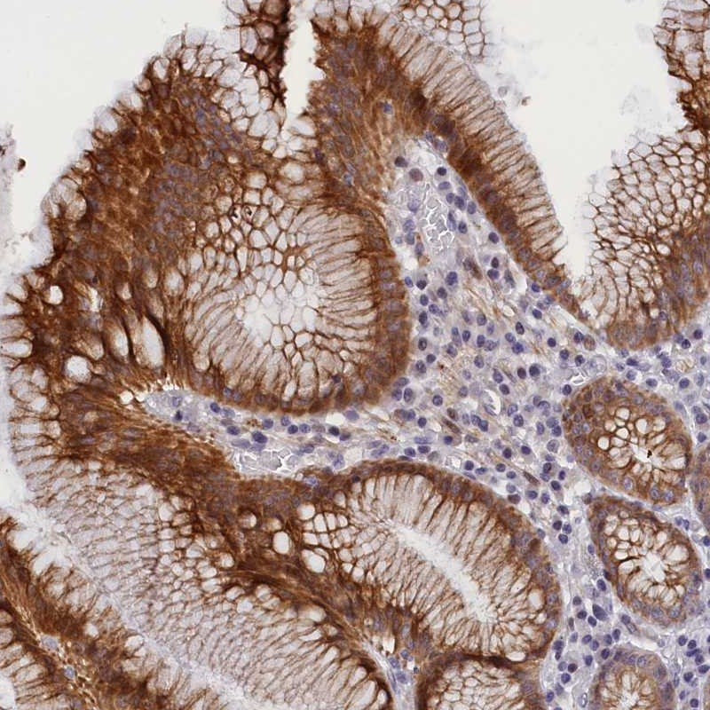 Immunohistochemical staining of human stomach, lower shows strong cytoplasmic positivity in glandular cells.