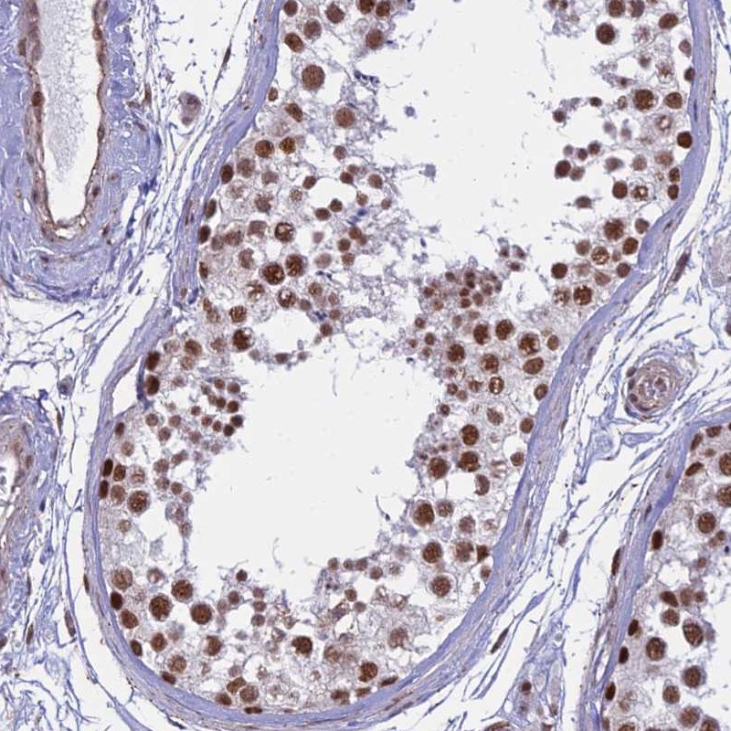 Immunohistochemical staining of human testis shows strong nuclear positivity in cells in seminiferus ducts.
