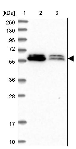 Lane 1: Marker [kDa] 250, 130, 95, 72, 55, 36, 28, 17, 10<br/>Lane 2: Human cell line RT-4<br/>Lane 3: Human cell line U-251MG sp