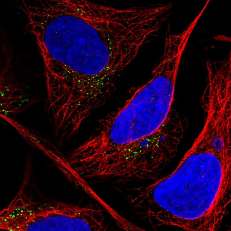 Immunofluorescent staining of human cell line U-2 OS shows localization to vesicles.