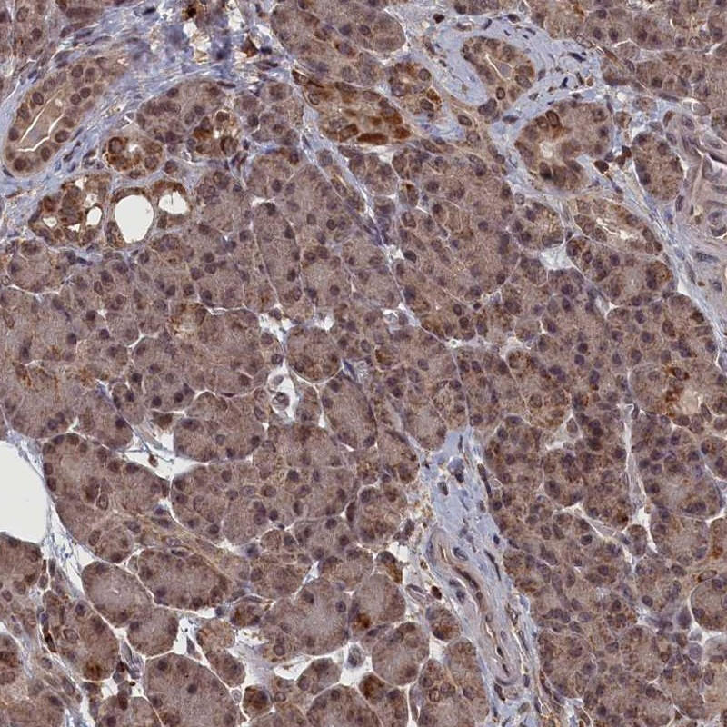 Immunohistochemical staining of human pancreas shows moderate cytoplasmic and nuclear positivity in exocrine glandular cells.