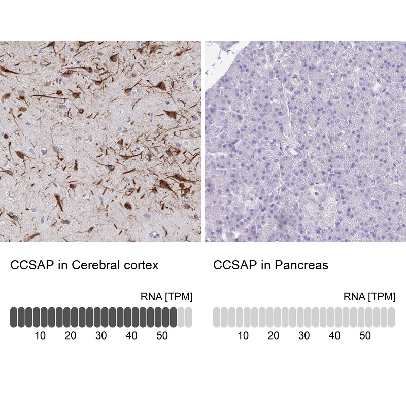 Immunohistochemistry analysis in human cerebral cortex and pancreas tissues using Anti-CCSAP antibody. Corresponding CCSAP RNA-seq data are presented for the same tissues.