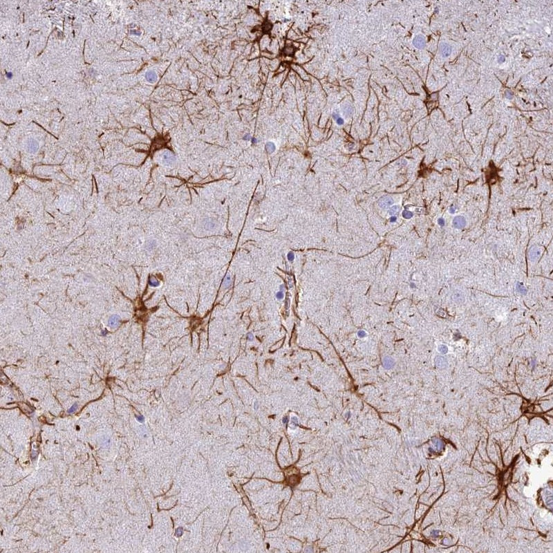 Immunohistochemical staining of human caudate shows distinct positivity in astrocytes.