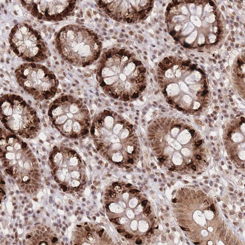 Immunohistochemical staining of human colon shows strong nuclear and cytoplasmic positivity in glandular cells.