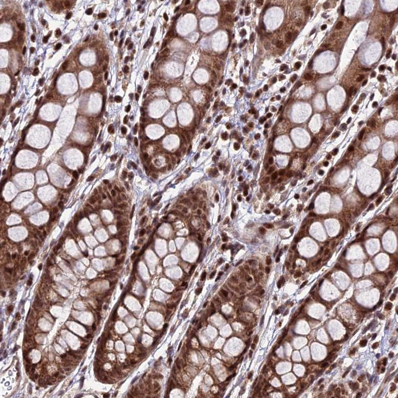Immunohistochemical staining of human rectum shows moderate cytoplasmic and nuclear positivity in glandular cells.