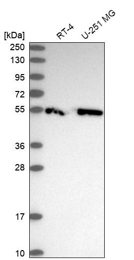 Western blot analysis in human cell line RT-4 and human cell line U-251 MG.
