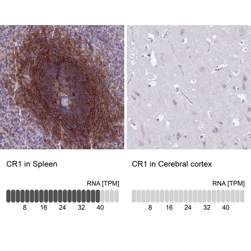 Immunohistochemistry analysis in human spleen and cerebral cortex tissues using Anti-CR1 antibody. Corresponding CR1 RNA-seq data are presented for the same tissues.