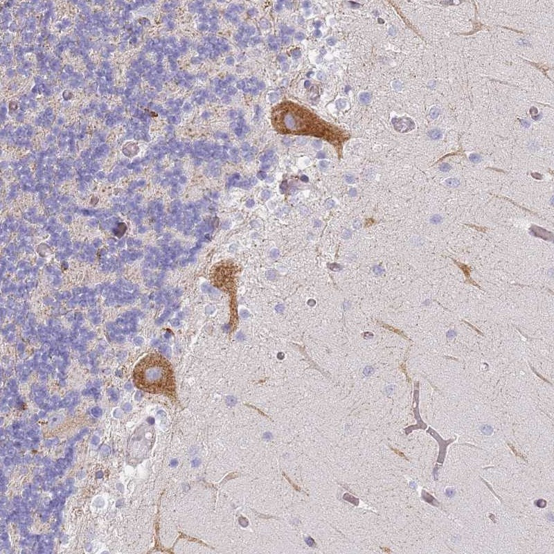 Immunohistochemical staining of human cerebellum shows strong cytoplasmic positivity in Purkinje cells.