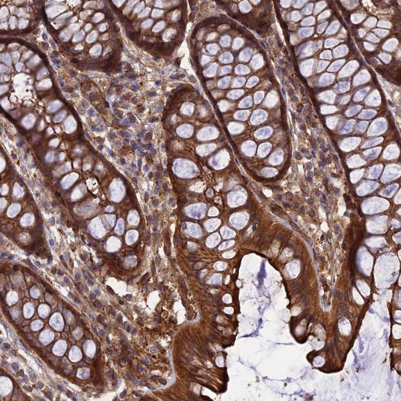 Immunohistochemical staining of human colon shows strong cytoplasmic and membranous positivity in glandular cells.