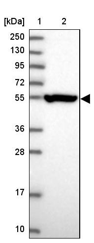 Lane 1: Marker [kDa] 250, 130, 95, 72, 55, 36, 28, 17, 10<br/>Lane 2: Human cell line RT-4