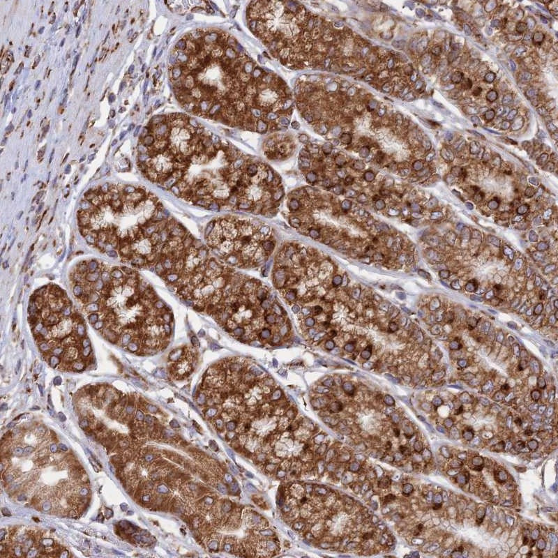 Immunohistochemical staining of human stomach, upper shows strong cytoplasmic positivity in glandular cells.