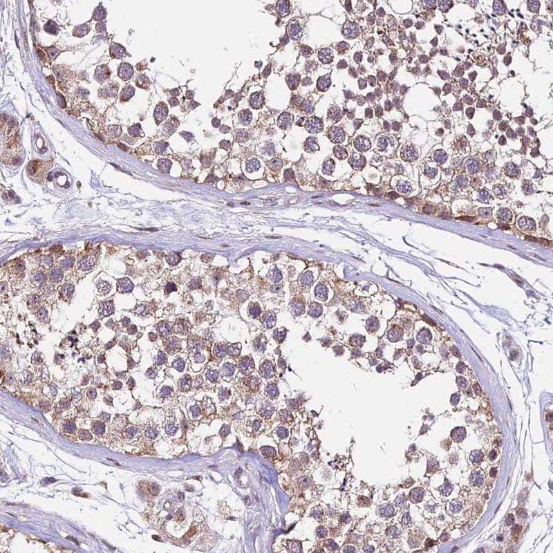 Immunohistochemical staining of human testis shows moderate cytoplasmic positivity in cells in seminiferus ducts.