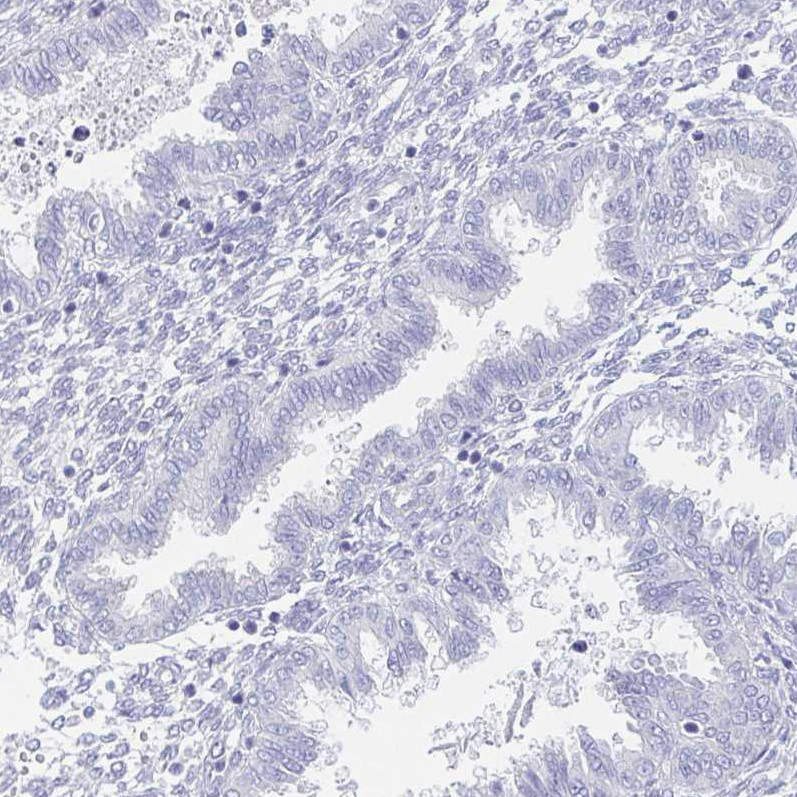 Immunohistochemical staining of human endometrium shows no positivity in glandular cells as expected.