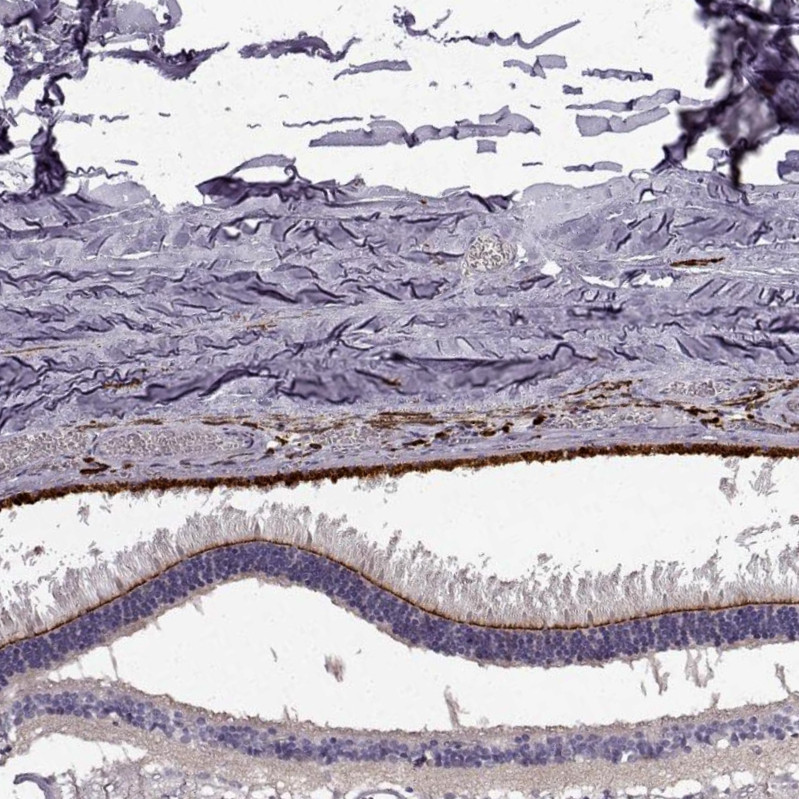 Immunohistochemical staining of human Eye, retina shows strong positivity in outer limiting membrane.
