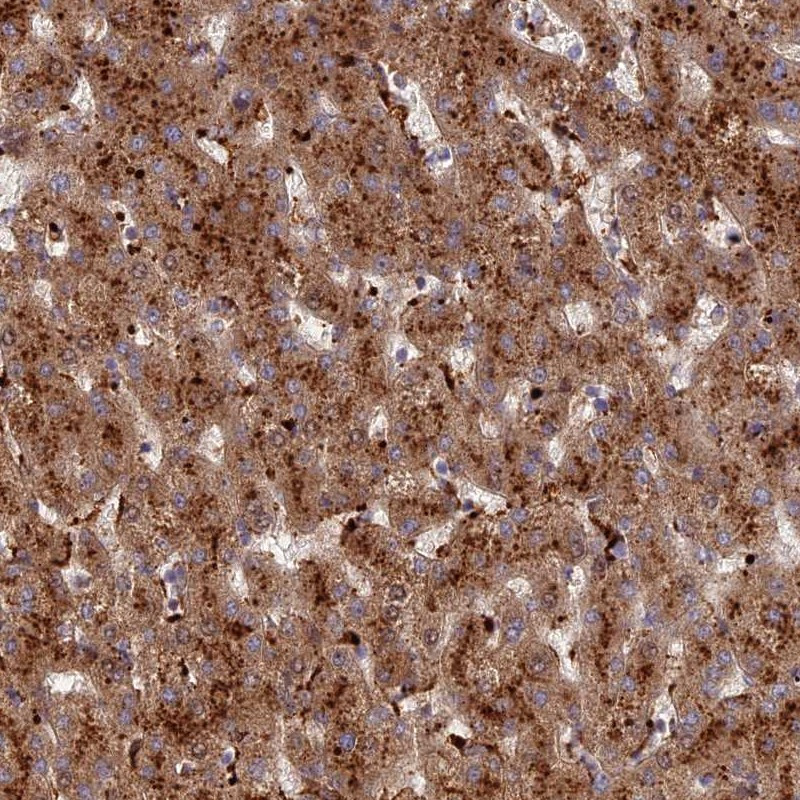 Immunohistochemical staining of human liver shows strong cytoplasmic positivity (granular pattern) in hepatocytes.