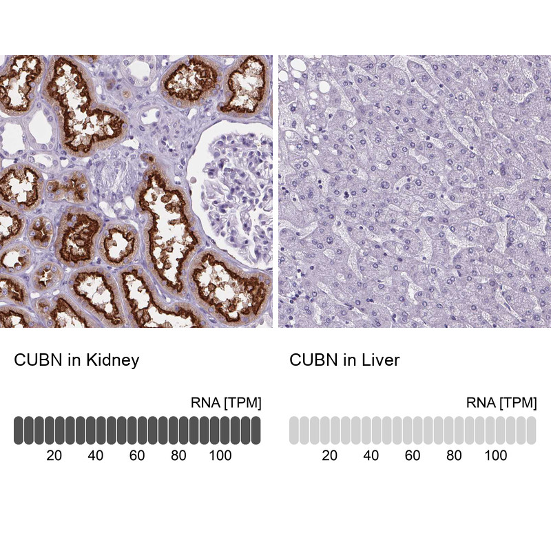 Immunohistochemistry analysis in human kidney and liver tissues using HPA043854 antibody. Corresponding CUBN RNA-seq data are presented for the same tissues.