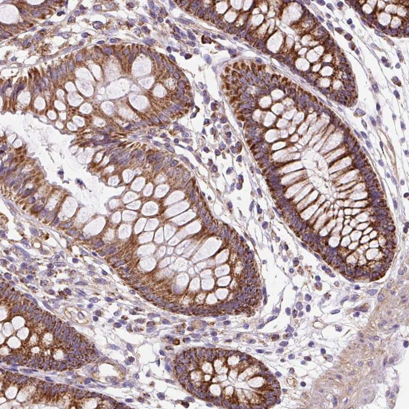 Immunohistochemical staining of human colon shows strong cytoplasmic positivity with a granular pattern in glandular cells.