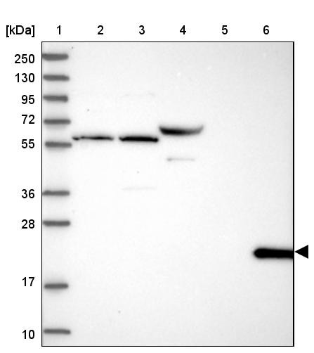 Lane 1: Marker [kDa] 250, 130, 95, 72, 55, 36, 28, 17, 10<br/>Lane 2: Human cell line RT-4<br/>Lane 3: Human cell line U-251 MG<br/>Lane 4: Human plasma<br/>Lane 5: Human Liver tissue<br/>Lane 6: Human Tonsil tissue