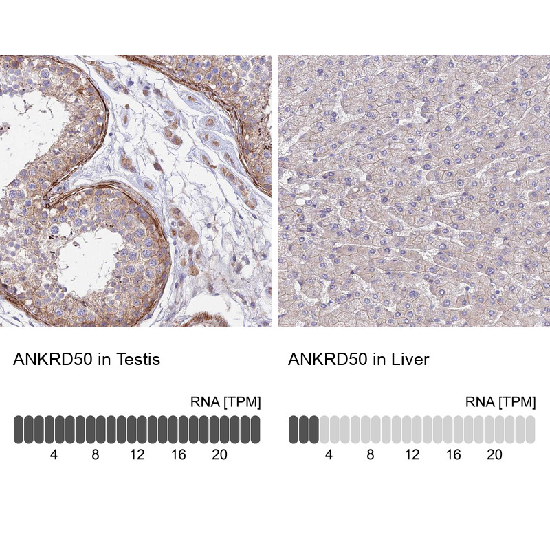 Immunohistochemistry analysis in human testis and liver tissues using HPA044008 antibody. Corresponding ANKRD50 RNA-seq data are presented for the same tissues.