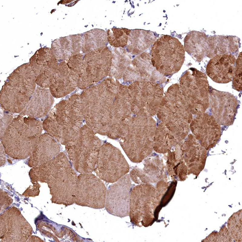 Immunohistochemical staining of human skeletal muscle shows strong cytoplasmic positivity in myocytes.