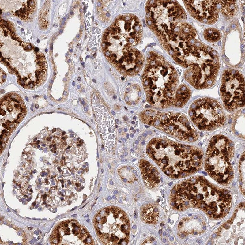Immunohistochemical staining of human kidney shows strong cytoplasmic positivity in cells in tubules.