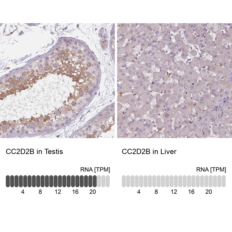 Immunohistochemistry analysis in human testis and liver tissues using Anti-CC2D2B antibody. Corresponding CC2D2B RNA-seq data are presented for the same tissues.