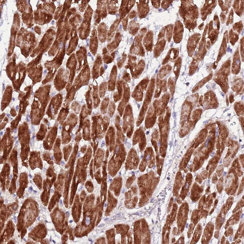 Immunohistochemical staining of human heart muscle shows strong cytoplasmic positivity in myocytes.