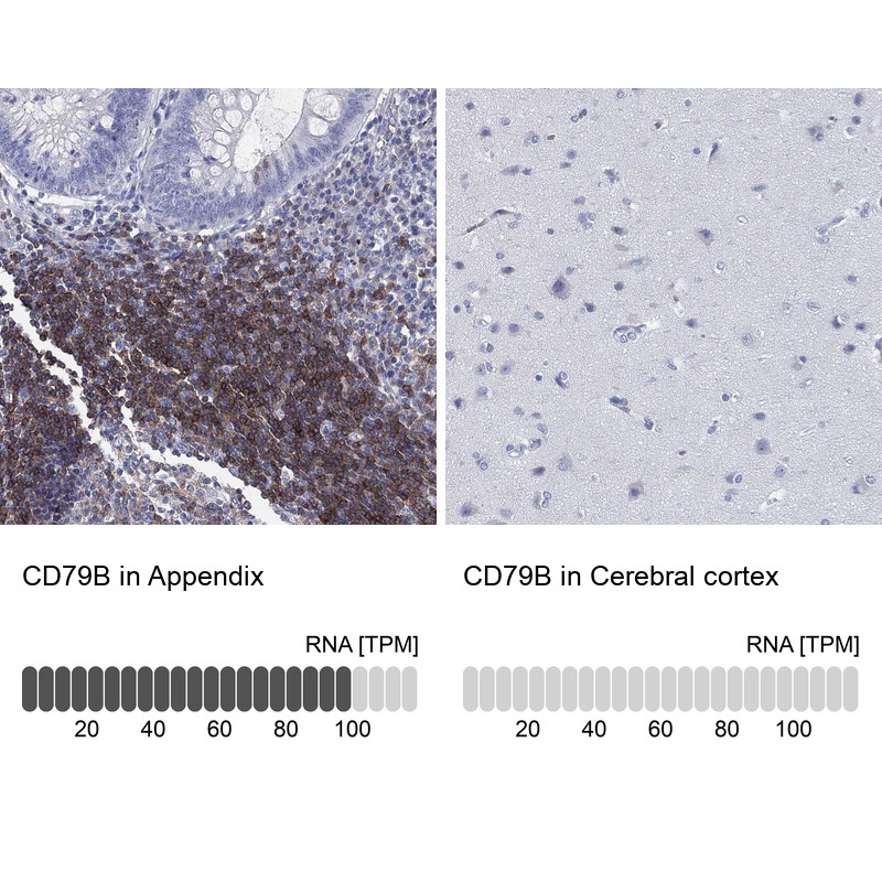 Immunohistochemistry analysis in human appendix and cerebral cortex tissues using Anti-CD79B antibody. Corresponding CD79B RNA-seq data are presented for the same tissues.