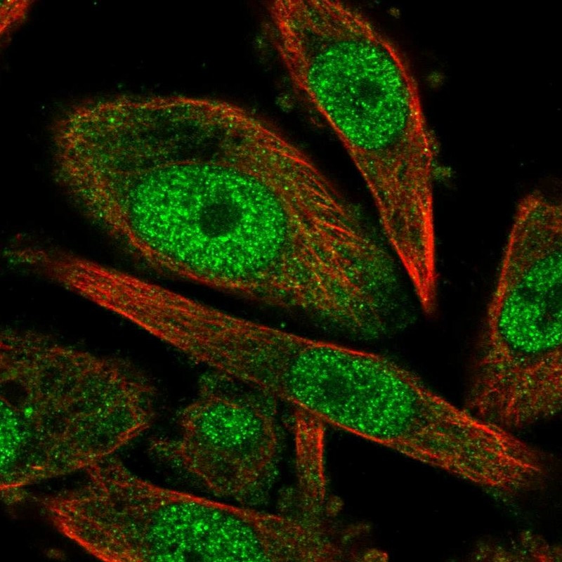 Immunofluorescent staining of human cell line PC-3 shows localization to nucleoplasm.