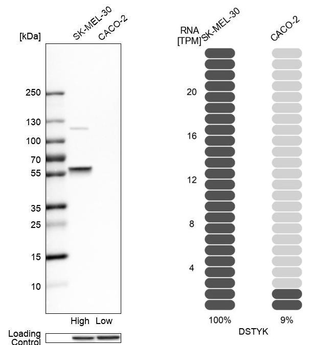 Western blot analysis in human cell lines SK-MEL-30 and Caco-2 using Anti-DSTYK antibody. Corresponding DSTYK RNA-seq data are presented for the same cell lines. Loading control: Anti-HDAC1.