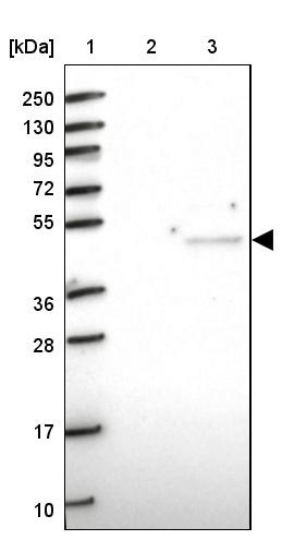 Lane 1: Marker [kDa] 250, 130, 95, 72, 55, 36, 28, 17, 10<br/>Lane 2: Human cell line RT-4<br/>Lane 3: Human cell line U-251MG sp